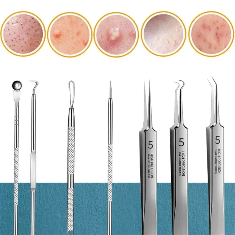 11-Piece Blackhead & Acne Removal Tool Set – Precision Tweezers & Extractors